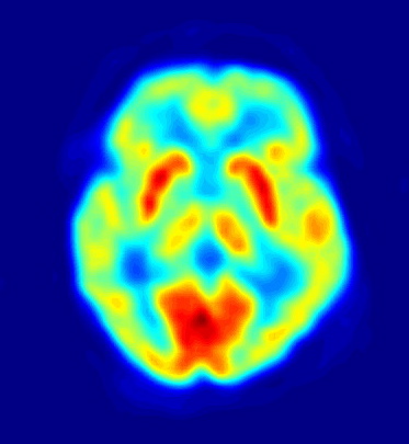 Metodología de la investigación en las Neurociencias